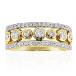 IF (D) Brillant-Goldring